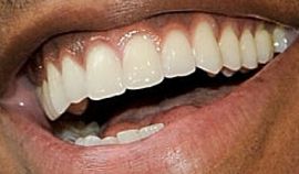Picture of Mehcad Brooks teeth and smile