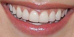 Picture of Melissa Benoist teeth and smile
