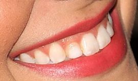 Picture of Melissa Benoist teeth and smile