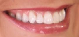 Picture of Melissa Claire Egan teeth and smile
