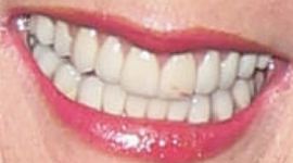 Picture of Melody Thomas Scott teeth and smile