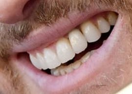 Picture of Michael Buble teeth and smile