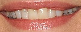 Picture of Michelle Pfeiffer's teeth while smiling