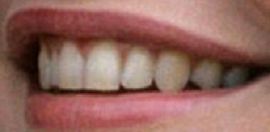 Picture of Michelle Pfeiffer's teeth while smiling