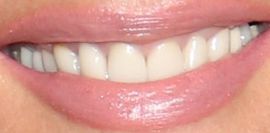 Picture of Michelle Stafford teeth and smile