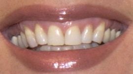 Picture of Michelle Stafford teeth and smile