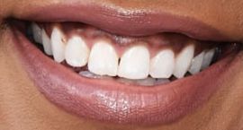 Picture of Mickey Guyton teeth and smile