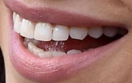 Picture of Mila Kunis's teeth while smiling