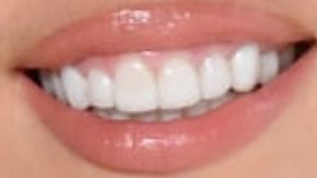 Miley Cyrus teeth and smile