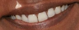 Picture of Mindy Kaling teeth and smile