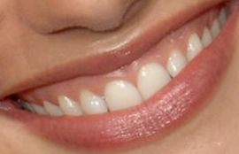 Picture of Minka Kelly teeth and smile