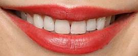 Picture of Miranda Cosgrove teeth and smile