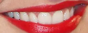 Picture of Miranda Kerr teeth and smile