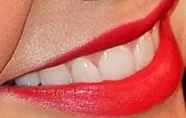 Picture of Miranda Kerr teeth and smile