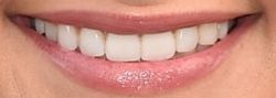 Picture of Miranda Lambert teeth and smile