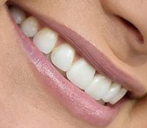 Picture of Miranda Lambert teeth and smile
