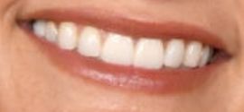 Miranda Lambert teeth