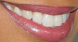 Picture of Mishael Morgan teeth and smile