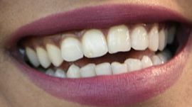 Picture of Monica Raymund teeth and smile