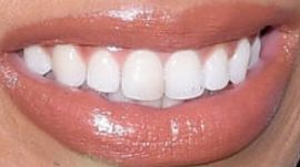 Picture of Monique Samuels teeth and smile