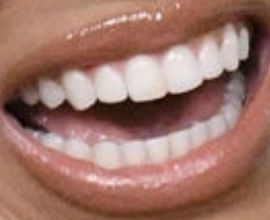Picture of Monique Samuels teeth and smile