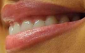 Picture of Nadia Bjorlin teeth and smile