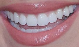 Picture of Nadia Bjorlin teeth and smile