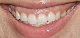 Picture of Naima Mora teeth and smile