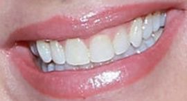 Picture of Nancy Lee Grahn teeth and smile