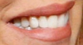 Picture of Nancy Lee Grahn teeth and smile