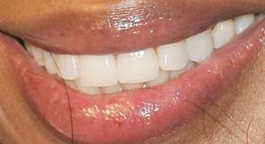 Picture of Naomi Campbell teeth and smile