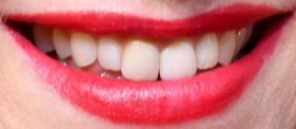 Picture of Naomi Watts teeth and smile