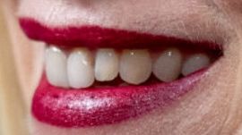 Picture of Naomi Watts teeth and smile
