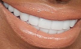 Picture of NeNe Leakes teeth and smile