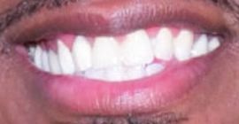 Picture of Nick Cannon teeth and smile