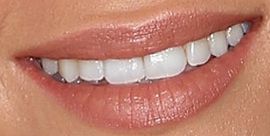 Picture of Nicola Peltz teeth and smile