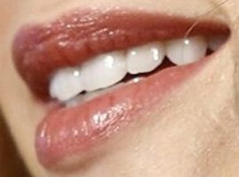 Picture of Nicola Peltz teeth and smile