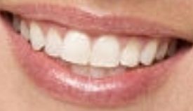 Picture of Nicole Franzel teeth and smile
