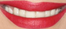 Picture of Nikki Bella teeth and smile