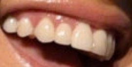 Picture of Nikki Bella teeth and smile