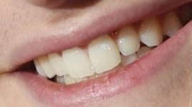 Picture of Noah Schnapp teeth and smile