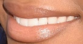 Picture of Normani Kordei teeth and smile