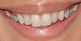 Picture of Odette Annable teeth and smile