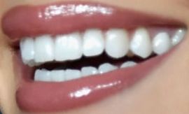 Picture of Olivia Culpo teeth and smile