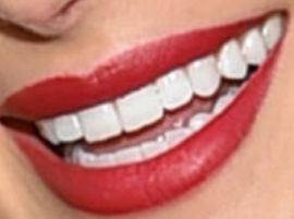 Picture of Olivia Culpo teeth and smile