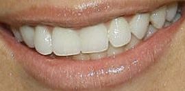 Picture of Olivia Munn teeth and smile