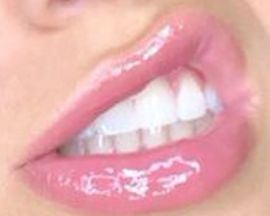 Picture of Olivia Ponton teeth and smile