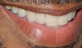 Picture of Omari Hardwick teeth and smile