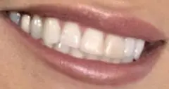 Picture of Pamela Anderson teeth and smile