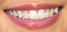 Picture of Paris Berelc teeth and smile